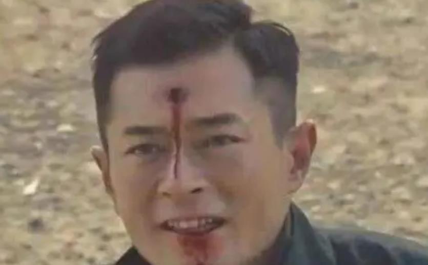 逆境中的重生，男主角的枪伤与取子弹历程，逆境重生，枪伤下的子弹取出之路